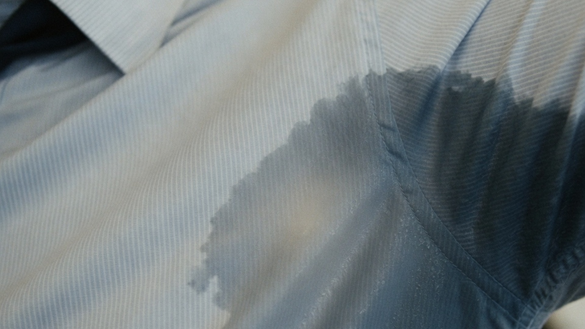 Hyperhidrosis Treatment treatment at Laser Aesthetics in Burlington, Ontario